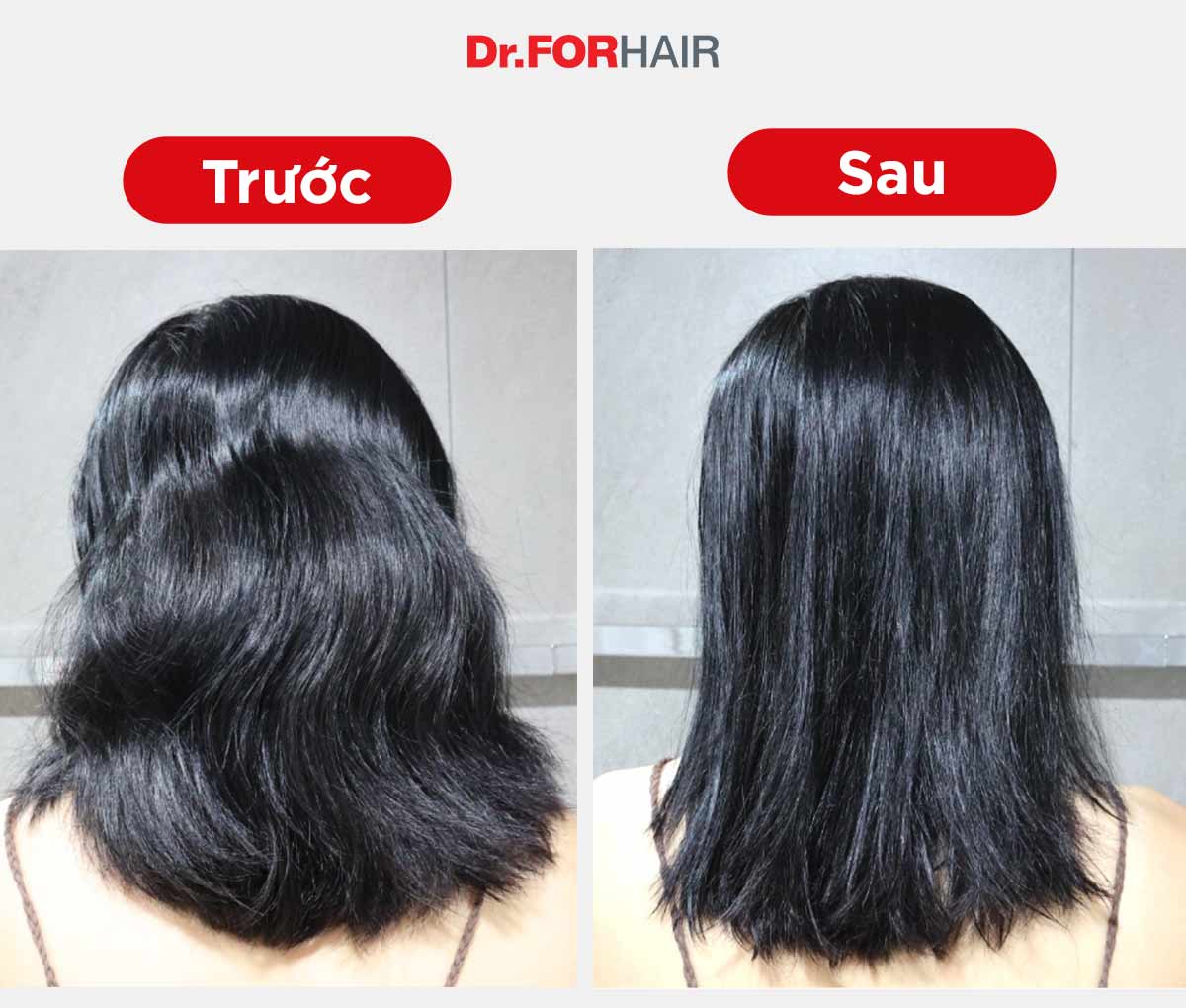 Hiệu quả thực tế trước và sau khi sử dụng dầu gội Dr.FORHAIR Folligen Original