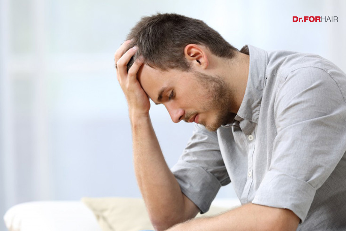nguyên nhân gây rụng tóc nhiều ở nam
