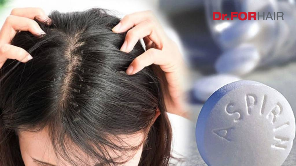 Trị gàu bằng aspirin