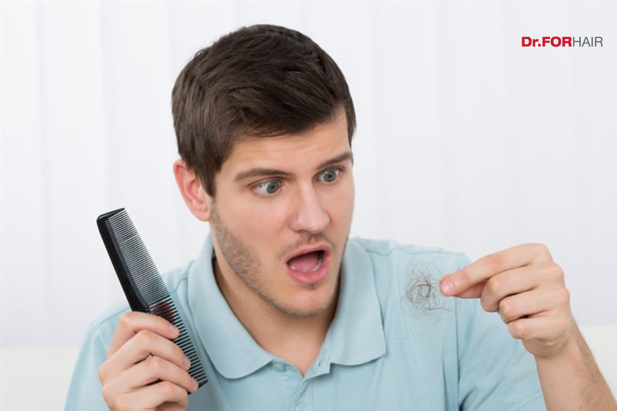 nguyên nhân rụng tóc nhiều ở nam
