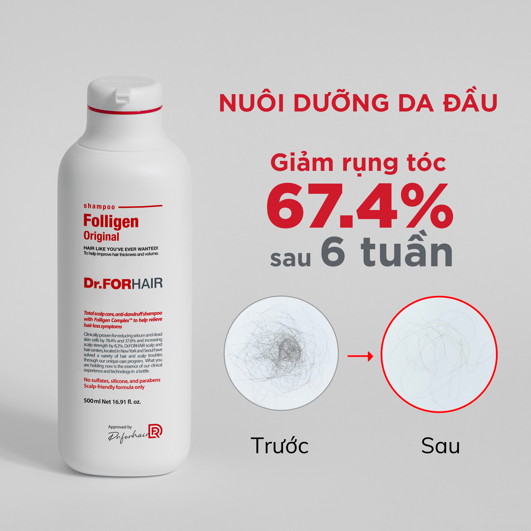 Dầu gội Folligen Original cải thiện tình trạng rụng tóc đáng kể