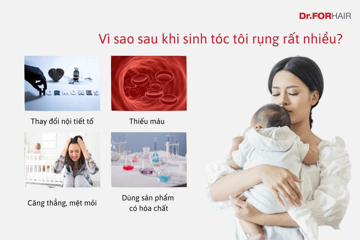 dầu gội trị rụng tóc sau sinh