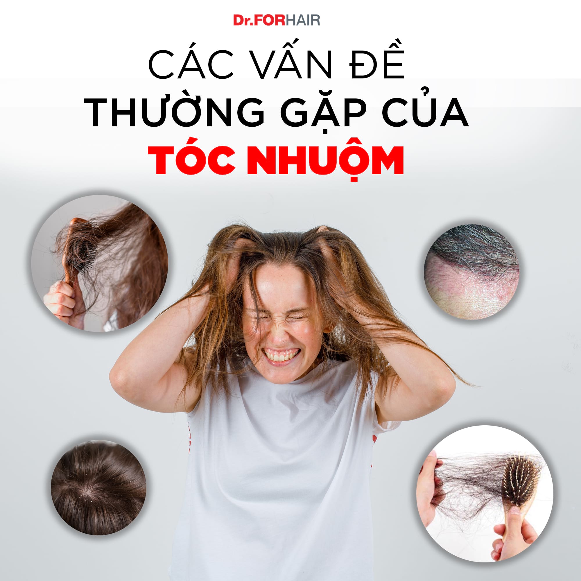 dầu gội trị rụng tóc