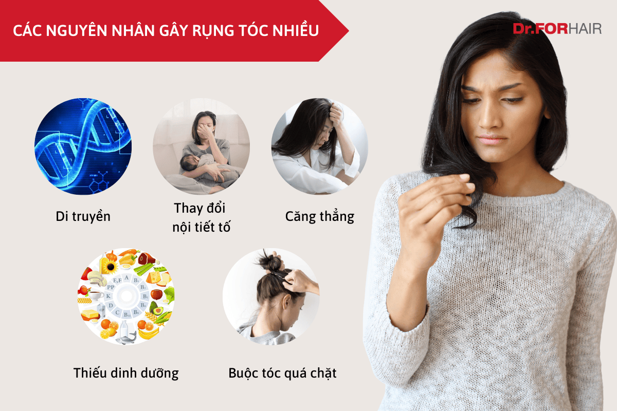 trị rụng tóc